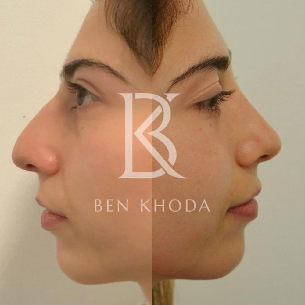 Plastic Surgeon Marylebone | Cosmetic Surgery London | Dr Ben Khoda Surgery