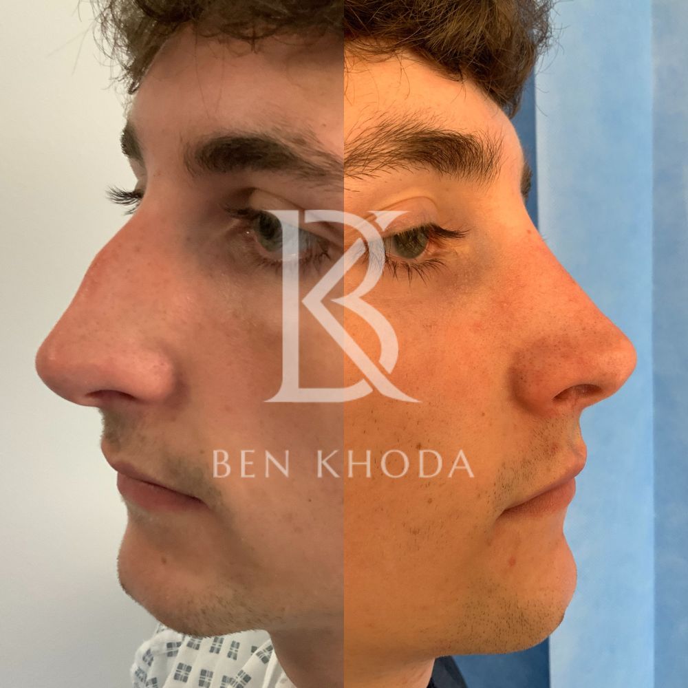 Plastic Surgeon Marylebone | Cosmetic Surgery London | Dr Ben Khoda Surgery