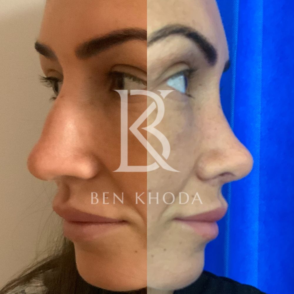 Plastic Surgeon Marylebone | Cosmetic Surgery London | Dr Ben Khoda Surgery