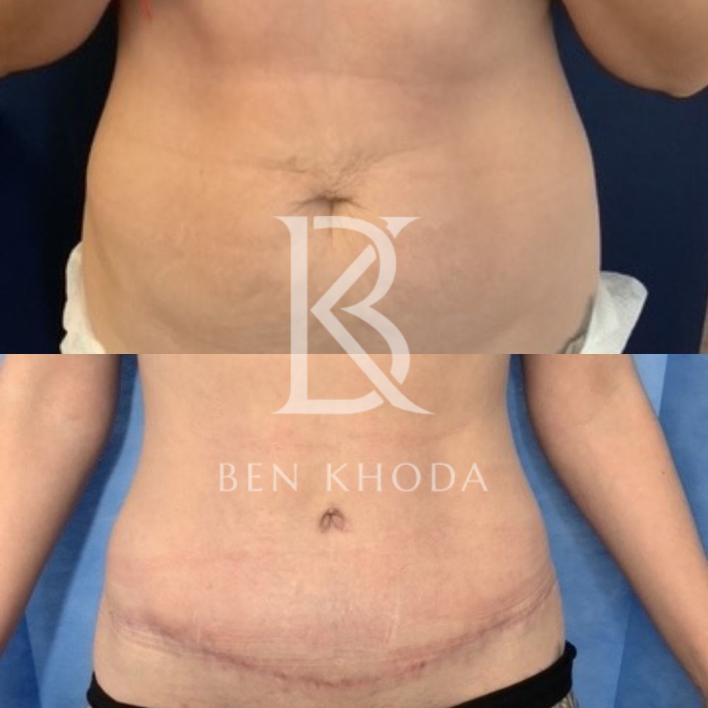 Plastic Surgeon Marylebone | Cosmetic Surgery London | Dr Ben Khoda Surgery