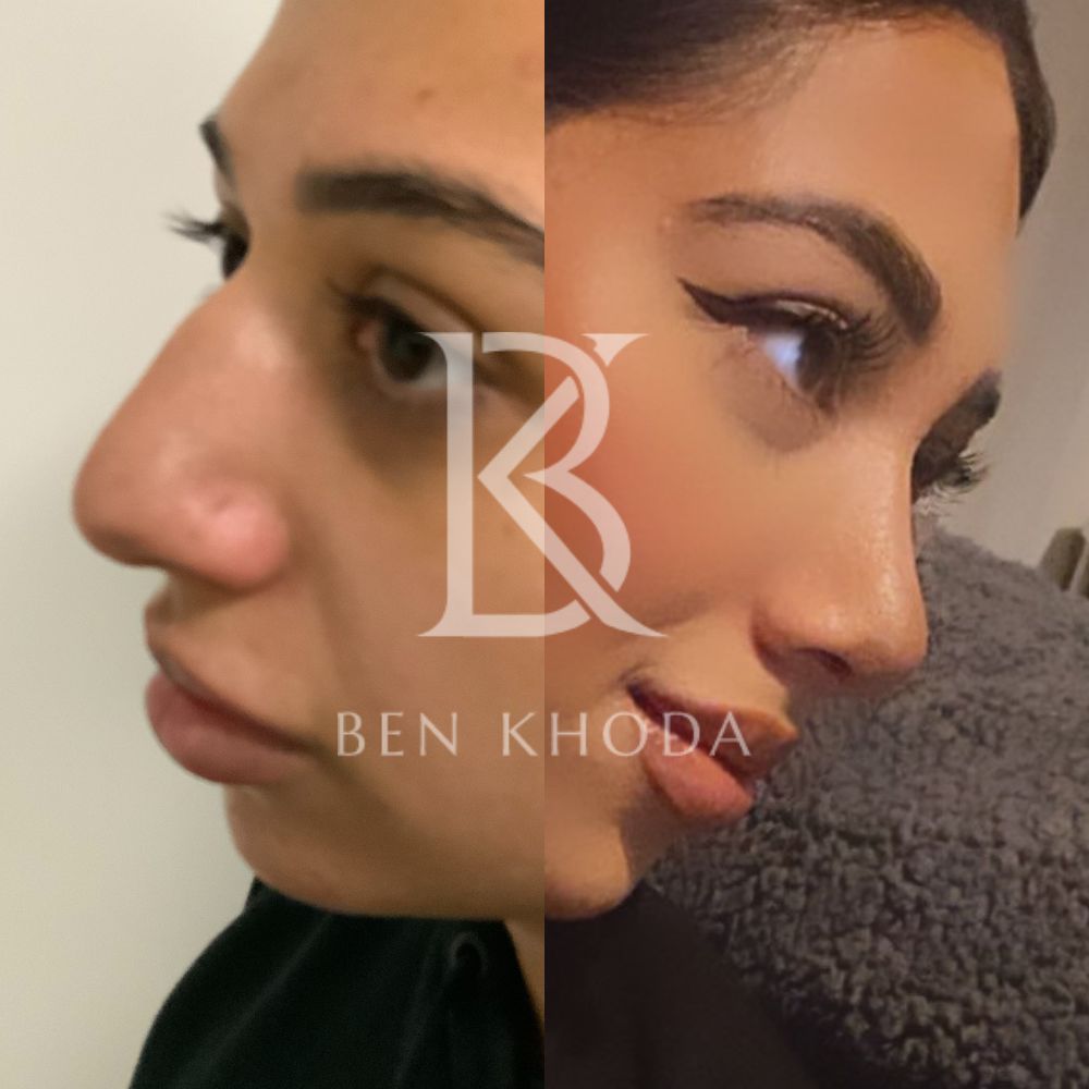 Plastic Surgeon Marylebone | Cosmetic Surgery London | Dr Ben Khoda Surgery