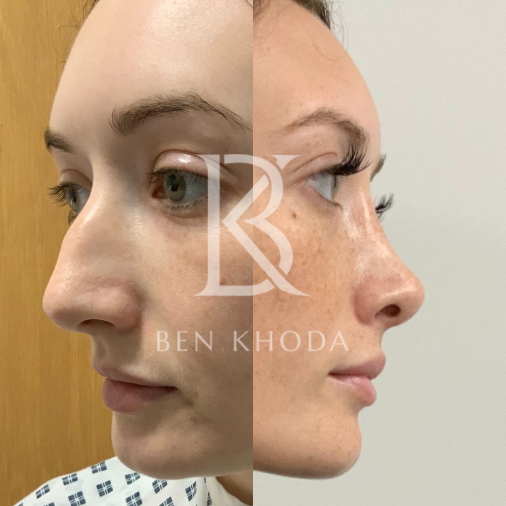 Plastic Surgeon Marylebone | Cosmetic Surgery London | Dr Ben Khoda Surgery