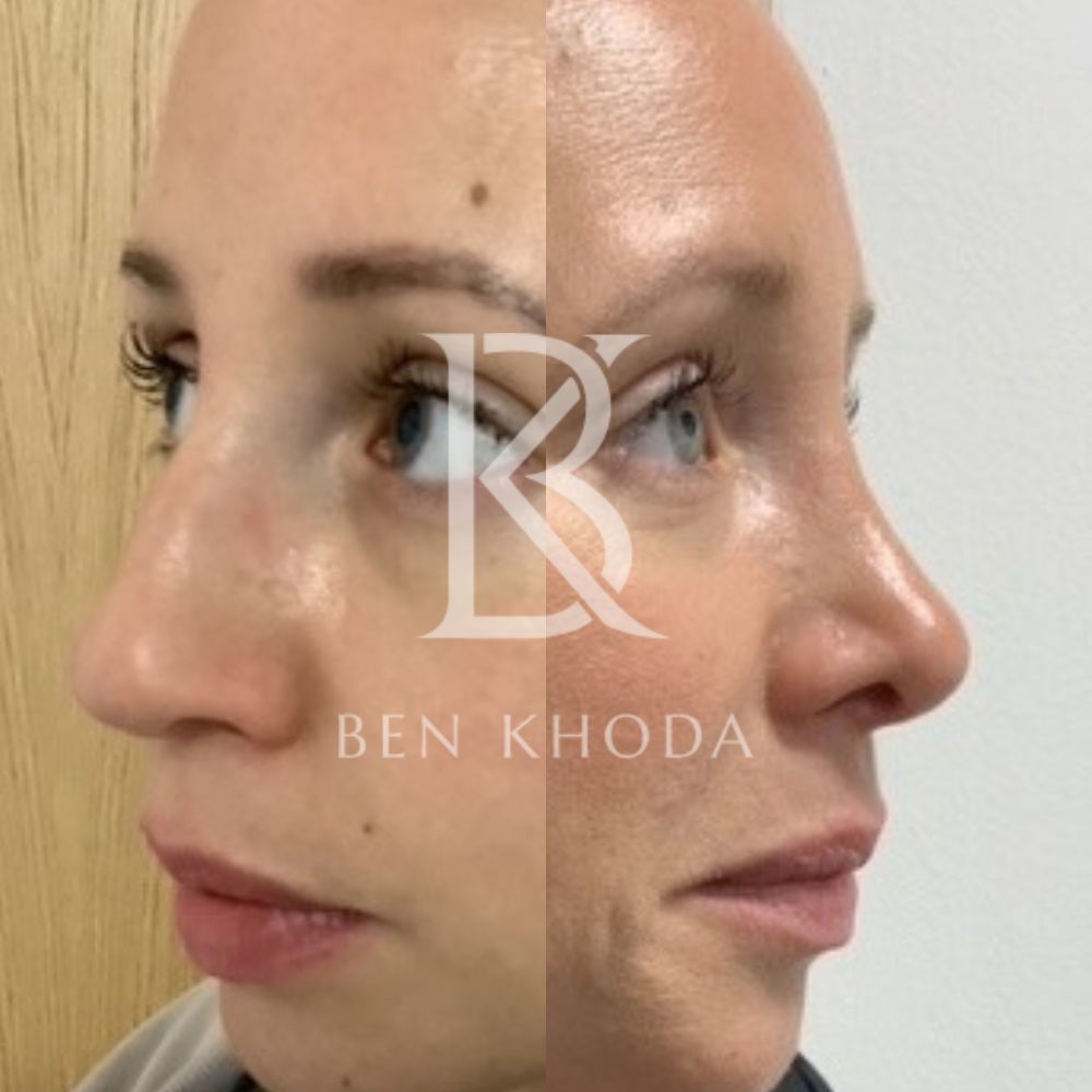 Plastic Surgeon Marylebone | Cosmetic Surgery London | Dr Ben Khoda Surgery