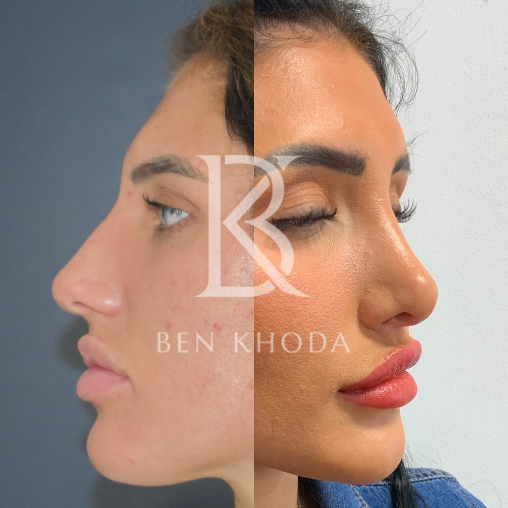 Plastic Surgeon Marylebone | Cosmetic Surgery London | Dr Ben Khoda Surgery