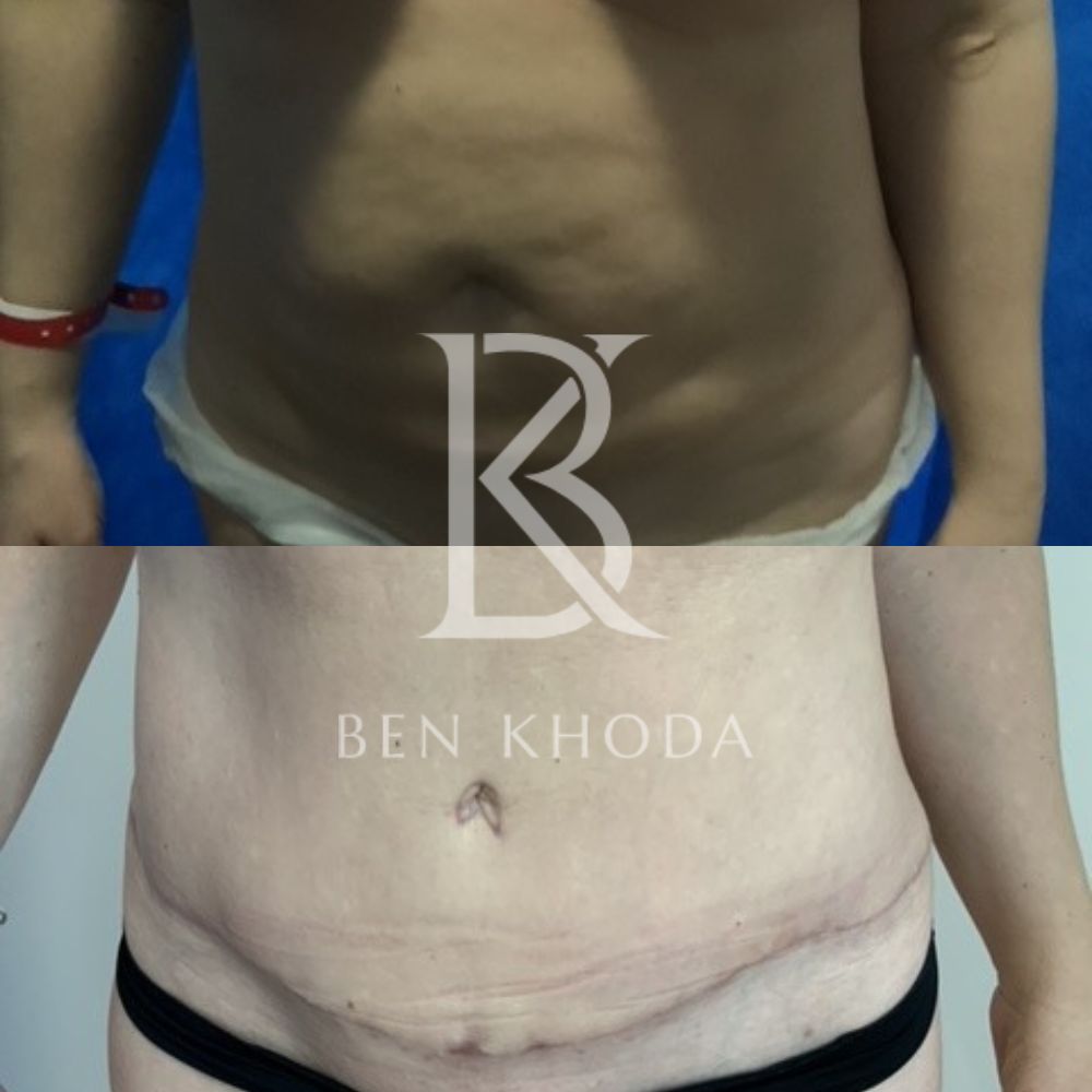 Plastic Surgeon Marylebone | Cosmetic Surgery London | Dr Ben Khoda Surgery